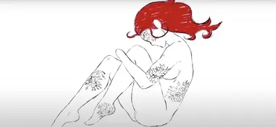 Gestión colaborativa de la medicación y su implementación en España, foco en desórdenes graves de salud mental
