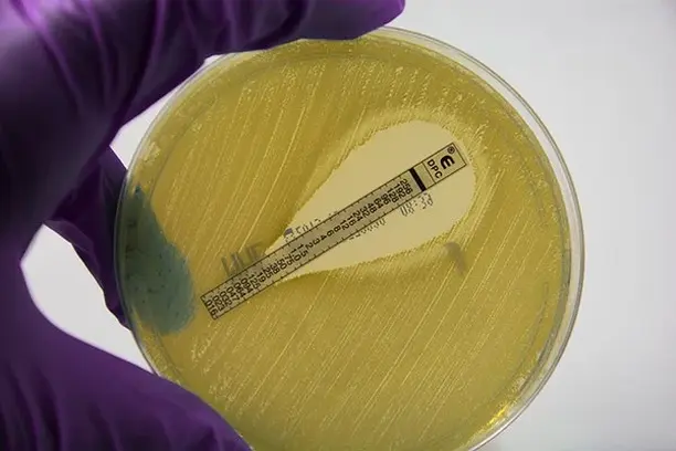 Image for SWI@Spain: Implantación y Consolidación en España de Small World Initiative, un proyecto de ciencia ciudadana para el uso racional y descubrimiento de nuevos antibióticos