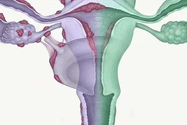 Image for ENDO-HIT